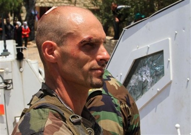  AP Photo An injured French UN peacekeeper soldier, stands next of his damaged armored vehicle, in Touline village, south of Lebanon, on Saturday July 3, 2010. A Lebanese military official says southern Lebanese villagers attacked a U.N. patrol with stones and eggs after the peacekeepers detained a villager. An Associated Press photographer saw at least one peacekeeper and one villagers slightly injured.