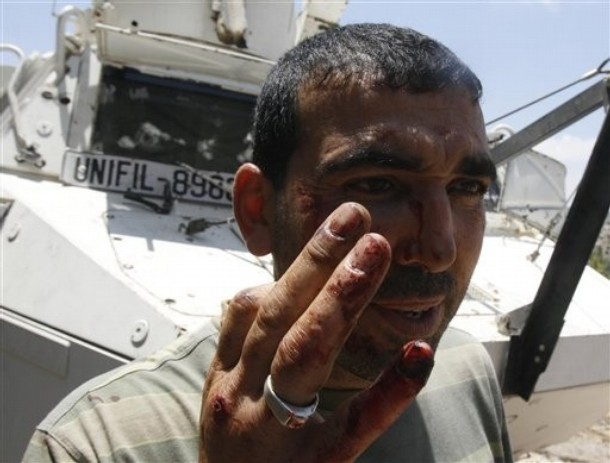  AP Photo An injured Lebanese villager Ali Melhem, walks in front of a damaged armored vehicle of the French UN peacekeepers, in Touline village, south of Lebanon, on Saturday July 3, 2010. A Lebanese military official says southern Lebanese villagers attacked a U.N. patrol with stones and eggs after the peacekeepers detained a villager. An Associated Press photographer saw at least one peacekeeper and one villagers slightly injured.