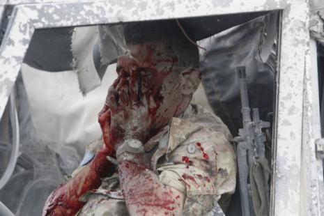 أحد الجنود المصابين في الشاحنة التابعة لليونيفيل بعيد الانفجار (شريف كريم - رويترز)